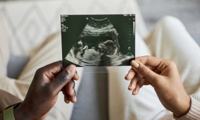 Closeup of ultrasound picture  